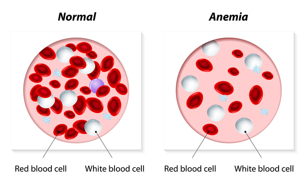 Autofluorescent Red Blood Cells in Protoporphyria